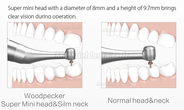 Woodpecker Ai-Motor Moteur d’endodontie dentaire sans fil